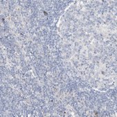 抗-DNAH5 兔抗 Prestige Antibodies® Powered by Atlas Antibodies, affinity isolated antibody, buffered aqueous glycerol solution