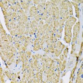 Anti-Hexokinase II antibody produced in rabbit