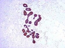 抗细胞角蛋白19抗体（克隆RCK108） clone RCK108, Chemicon®, from mouse