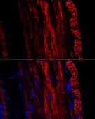 Anti-alpha smooth muscle actin antibody produced in rabbit