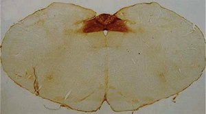 抗-聚唾液酸-NCAM抗体，克隆2-2B ascites fluid, clone 2-2B, Chemicon®