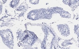 Anti-β Tubulin Antibody, clone 10G11 ZooMAb® Rabbit Monoclonal recombinant, expressed in HEK 293 cells