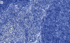 Anti-IL-17A Antibody, clone 3K22 ZooMAb® Rabbit Monoclonal recombinant, expressed in HEK 293 cells