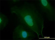 Monoclonal Anti-MYC antibody produced in mouse clone 1G7, purified immunoglobulin, buffered aqueous solution