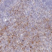 Anti-PTGDR antibody produced in rabbit Prestige Antibodies® Powered by Atlas Antibodies, affinity isolated antibody, buffered aqueous glycerol solution