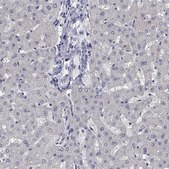 Anti-PRC1 antibody produced in rabbit Prestige Antibodies® Powered by Atlas Antibodies, affinity isolated antibody, buffered aqueous glycerol solution