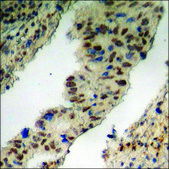 Anti-phospho-MEF2D (pSer444) antibody produced in rabbit affinity isolated antibody