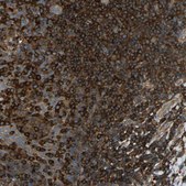 Anti-TLN1 antibody produced in rabbit Prestige Antibodies® Powered by Atlas Antibodies, affinity isolated antibody, buffered aqueous glycerol solution