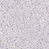 Anti-HAX1 antibody produced in rabbit Prestige Antibodies® Powered by Atlas Antibodies, affinity isolated antibody, buffered aqueous glycerol solution