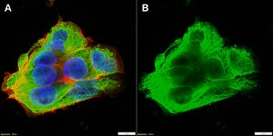 Anti-β2-Adrenergic Receptor Antibody, clone 2B23 ZooMAb® Rabbit Monoclonal recombinant, expressed in HEK 293 cells