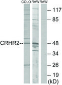Anti-CRHR2 antibody produced in rabbit affinity isolated antibody