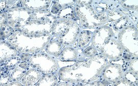 Anti-TXNIP Antibody, clone 1K14 ZooMAb® Rabbit Monoclonal recombinant, expressed in HEK 293 cells