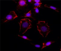 Anti-Caveolin-1 antibody produced in rabbit IgG fraction of antiserum, buffered aqueous solution