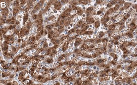 Anti-Catalase Antibody, clone 1C21 ZooMAb® Rabbit Monoclonal recombinant, expressed in HEK 293 cells