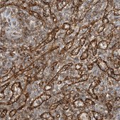 Anti-HLA-E antibody produced in rabbit Prestige Antibodies® Powered by Atlas Antibodies, affinity isolated antibody, buffered aqueous glycerol solution