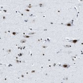Anti-TOP1 antibody produced in rabbit Prestige Antibodies® Powered by Atlas Antibodies, affinity isolated antibody, buffered aqueous glycerol solution
