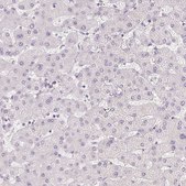 Anti-PLCB1 antibody produced in rabbit Prestige Antibodies® Powered by Atlas Antibodies, affinity isolated antibody, buffered aqueous glycerol solution