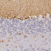 Anti-CBS antibody produced in rabbit Prestige Antibodies® Powered by Atlas Antibodies, affinity isolated antibody, buffered aqueous glycerol solution