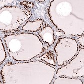 Monoclonal Anti-Nkx2-1 Antibody Produced In Mouse Prestige Antibodies® Powered by Atlas Antibodies, clone CL14523, affinity isolated antibody, buffered aqueous glycerol solution