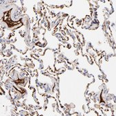 Anti-C3 antibody produced in rabbit Prestige Antibodies® Powered by Atlas Antibodies, affinity isolated antibody, buffered aqueous glycerol solution