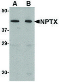 Anti-NPTX2 antibody produced in rabbit affinity isolated antibody, buffered aqueous solution