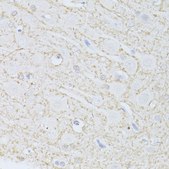 Anti-PHGDH antibody produced in rabbit