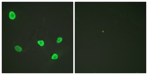 Anti-Histone H2B antibody produced in rabbit affinity isolated antibody