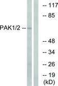Anti-PAK1 antibody produced in rabbit affinity isolated antibody