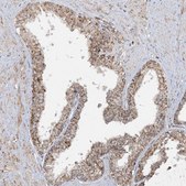 Anti-NDUFAF3 antibody produced in rabbit Prestige Antibodies® Powered by Atlas Antibodies, affinity isolated antibody, buffered aqueous glycerol solution