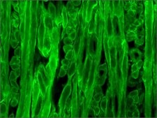 单克隆抗-肌养蛋白 小鼠抗 clone MANDYS8, ascites fluid