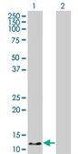 Monoclonal Anti-HBZ, (N-terminal) antibody produced in mouse clone 1G10, purified immunoglobulin, buffered aqueous solution