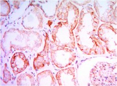 Anti-PTH1R Antibody, clone 4D2 ascites fluid, clone 4D2, from mouse