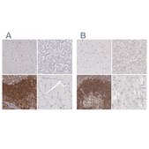 Anti-ARHGAP4 antibody produced in rabbit Ab1, Prestige Antibodies® Powered by Atlas Antibodies, affinity isolated antibody, buffered aqueous glycerol solution