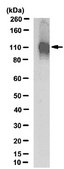 Anti-NMDAR1 Antibody, clone 1.17.2.6, rabbit monoclonal clone 1.17.2.6, from rabbit, unconjugated