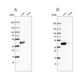 Anti-ACAT1 antibody produced in rabbit Ab1, Prestige Antibodies® Powered by Atlas Antibodies, affinity isolated antibody, buffered aqueous glycerol solution