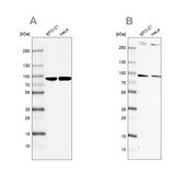 Anti-RPAP3 antibody produced in rabbit Prestige Antibodies® Powered by Atlas Antibodies, affinity isolated antibody, buffered aqueous glycerol solution
