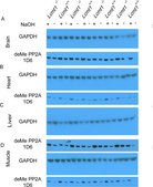 Anti-PP2A Antibody, C subunit, clone 1D6 clone 1D6, Upstate®, from mouse