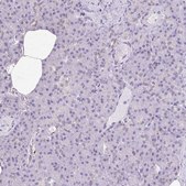 抗-HSPA1A 兔抗 Prestige Antibodies® Powered by Atlas Antibodies, affinity isolated antibody, buffered aqueous glycerol solution