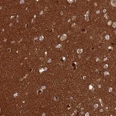 抗-CRBN 兔抗 Prestige Antibodies® Powered by Atlas Antibodies, affinity isolated antibody, buffered aqueous glycerol solution