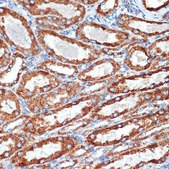 Anti-NDUFB8 antibody produced in rabbit