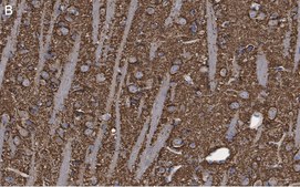 Anti-Synaptophysin Antibody, clone 1G7, ZooMAb® Rabbit Monoclonal recombinant, expressed in HEK 293 cells