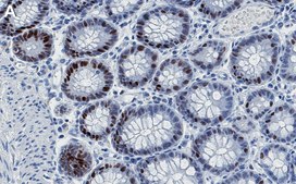 Anti-FOXA2 Antibody, clone 1H12 ZooMAb® Rabbit Monoclonal recombinant, expressed in HEK 293 cells