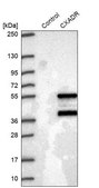 Anti-CXADR antibody produced in rabbit Prestige Antibodies® Powered by Atlas Antibodies, affinity isolated antibody, buffered aqueous glycerol solution, ab2
