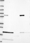 Anti-ALDH4A1 antibody produced in rabbit Prestige Antibodies® Powered by Atlas Antibodies, affinity isolated antibody, buffered aqueous glycerol solution
