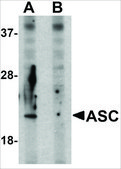Anti-ASC antibody produced in rabbit affinity isolated antibody, buffered aqueous solution