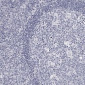 抗-DNALI1 兔抗 Prestige Antibodies® Powered by Atlas Antibodies, affinity isolated antibody, buffered aqueous glycerol solution