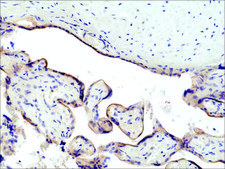 Anti-CD71 antibody, Rabbit monoclonal recombinant, expressed in HEK 293 cells, clone RM384, purified immunoglobulin