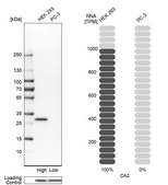 Anti-CA2 antibody produced in rabbit Prestige Antibodies® Powered by Atlas Antibodies, affinity isolated antibody, buffered aqueous glycerol solution