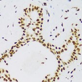Anti-FUS antibody produced in rabbit