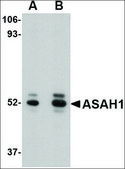 Anti-ASAH1 antibody produced in rabbit affinity isolated antibody, buffered aqueous solution